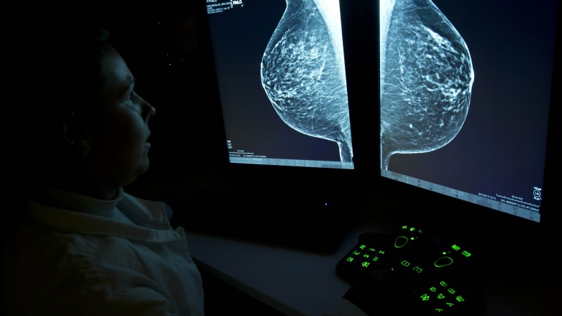  Mamografia